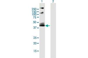 Western Blot analysis of ADRB2 expression in transfected 293T cell line by ADRB2 MaxPab polyclonal antibody. (beta 2 Adrenergic Receptor antibody  (AA 1-413))