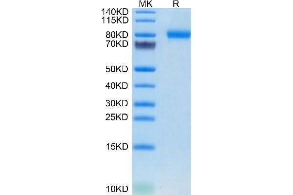 SEMA4B Protein (AA 31-703) (His tag)