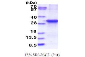 SDS-PAGE (SDS) image for Ankyrin Repeat and SOCS Box Containing 13 (ASB13) (AA 1-278) protein (His tag) (ABIN5853839)
