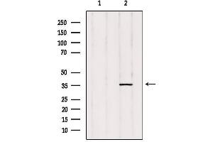 Western blot analysis of extracts from rat heart, using ZADH1 Antibody. (PTGR2 antibody  (Internal Region))