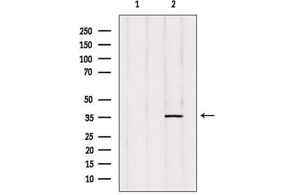 PTGR2 antibody  (Internal Region)