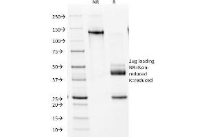 SDS-PAGE Analysis Purified NKX2. (Nkx2-2 antibody  (AA 1-119))