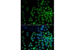 Immunofluorescence analysis of A-549 cells using F/F/UBD antibody (ABIN6131598, ABIN6149778, ABIN6149780 and ABIN6221159). (UBD antibody  (AA 1-165))