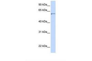 Image no. 1 for anti-24-Dehydrocholesterol Reductase (DHCR24) (AA 38-87) antibody (ABIN6738305) (Seladin 1 antibody  (AA 38-87))