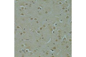 Immunohistochemistry of paraffin-embedded mouse brain using RSRC1 antibody (ABIN5974341) at dilution of 1/100 (40x lens). (RSRC1 antibody)