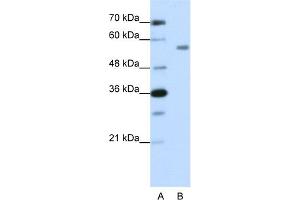 WB Suggested Anti-ZNF497 Antibody Titration:  1. (ZNF497 antibody  (N-Term))