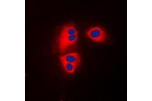 Immunofluorescent analysis of MRPL32 staining in HepG2 cells. (MRPL32 antibody  (Center))