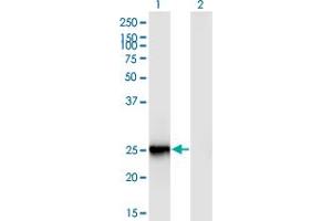 Western Blot analysis of FIGLA expression in transfected 293T cell line by FIGLA monoclonal antibody (M03), clone 6A10. (FIGLA antibody  (AA 110-219))