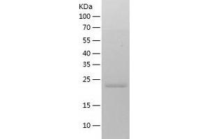 Western Blotting (WB) image for REX2, RNA Exonuclease 2 Homolog (REXO2) (AA 26-237) protein (His tag) (ABIN7124858) (REXO2 Protein (AA 26-237) (His tag))