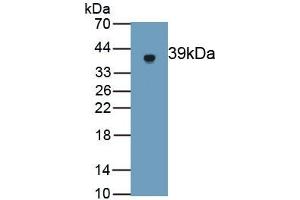 Detection of Recombinant GSDMD, Rat using Polyclonal Antibody to Gasdermin D (GSDMD) (GSDMD antibody  (AA 1-326))