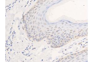 ABIN6267268 at 1/100 staining human skin tissue sections by IHC-P. (EGFR antibody  (pSer1026))