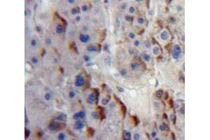 IHC-P analysis of Liver tissue, with DAB staining. (ADAM8 antibody  (AA 145-493))