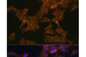 EIF2B2 antibody