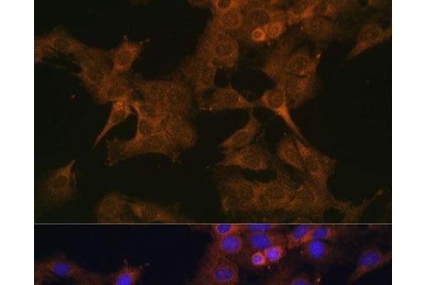 EIF2B2 antibody