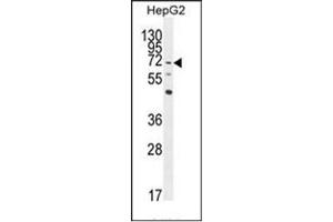 Western blot analysis of LRRC33 Antibody (C-term) in HepG2 cell line lysates (35ug/lane).