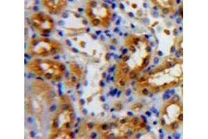 Used in DAB staining on fromalin fixed paraffin-embedded Kidney tissue (NR3C2 antibody  (AA 739-984))