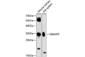 Western blot analysis of extracts of various cell lines, using GIM antibody (ABIN6127954, ABIN6141085, ABIN6141086 and ABIN6224753) at 1:3000 dilution.