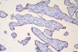 IHC analysis of HSD3B1 using anti-HSD3B1 antibody (ABIN7600266).
