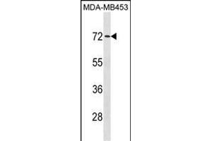 MEX3C Antibody (C-term) (ABIN1881540 and ABIN2839085) western blot analysis in MDA-M cell line lysates (35 μg/lane).