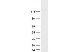 Validation with Western Blot (CHAF1A Protein (Myc-DYKDDDDK Tag))