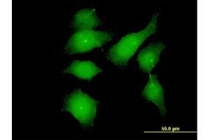 Immunofluorescence of monoclonal antibody to FGFR1OP on HeLa cell. (FGFR1OP antibody  (AA 1-379))