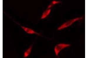 ABIN6275728 staining  LOVO cells by IF/ICC. (THO Complex 4 antibody  (Internal Region))