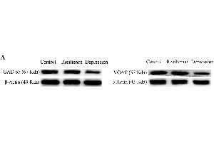 GABA synthesis, uptake and release are impaired in the nucleus accumbens of CUMS-induced depression mice, but not resilience miceThe expression and relative quantity of proteins GAD-67 and VGAT were studied by western-blot.