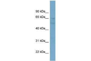 WB Suggested Anti-ZNF671 Antibody Titration:  0. (ZNF671 antibody  (N-Term))