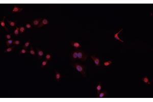ABIN6266604 staining Daudi cells by IF/ICC. (Oct-2 antibody)