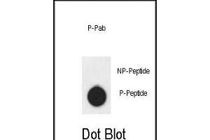 Dot blot analysis of anti-AKT1- Phospho-specific Pab (ABIN6241037 and ABIN6578932) on nitrocellulose membrane. (AKT1 antibody  (pSer124))