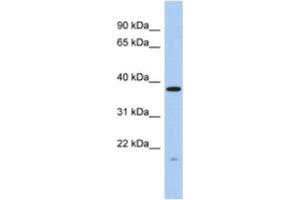 Western Blotting (WB) image for anti-RWD Domain Containing 2A (RWDD2A) antibody (ABIN2463922)
