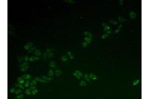Detection of HCCS in Hela cells using Polyclonal Antibody to Holocytochrome C Synthase (HCCS) (HCCS antibody  (AA 1-268))