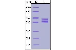 SDS-PAGE (SDS) image for Interleukin 2 Receptor, beta (IL2RB) (AA 27-239) protein (His tag,AVI tag,Biotin) (ABIN6950956)