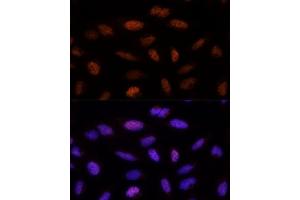 Immunofluorescence analysis of U-2 OS cells using ADNP Polyclonal Antibody (ABIN1678582, ABIN3019032, ABIN3019033 and ABIN6220678) at dilution of 1:100 (40x lens). (ADNP antibody  (AA 843-1102))