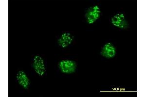 Immunofluorescence of purified MaxPab antibody to USP16 on HeLa cell. (USP16 antibody  (AA 1-822))