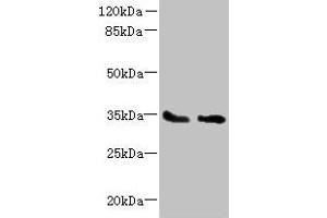 Western blot All lanes: SLC25A36 antibody at 4 μg/mL Lane 1: A431 whole cell lysate Lane 2: A549 whole cell lysate Secondary Goat polyclonal to rabbit IgG at 1/10000 dilution Predicted band size: 35, 15, 18 kDa Observed band size: 35 kDa (SLC25A36 antibody  (AA 58-110))
