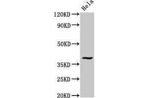 Western Blot Positive WB detected in: Hela whole cell lysate All lanes: DUSP1 antibody at 3. (DUSP1 antibody  (AA 125-236))