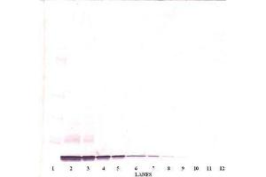 Image no. 2 for anti-Chemokine (C-X-C Motif) Ligand 14 (CXCL14) antibody (ABIN465239) (CXCL14 antibody)
