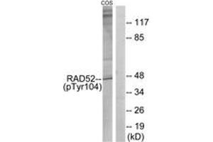 Western blot analysis of extracts from COS7 cells treated with H2O2 100uM 30', using RAD52 (Phospho-Tyr104) Antibody. (RAD52 antibody  (pTyr104))