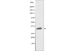 RASD2 antibody  (Internal Region)