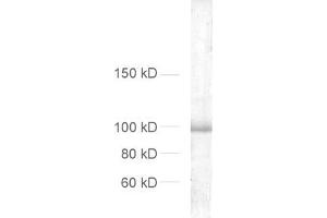 dilution: 1 : 1000, sample: crude synaptosomal fraction of rat brain (P2) (DLG4 antibody  (AA 18-32))