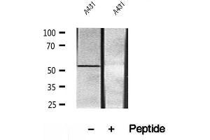 Western blot analysis of extracts of A431 cells, using UBAP1 antibody.