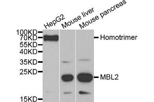 Western blot analysis of extracts of various cell lines, using MBL2 antibody. (MBL2 antibody)