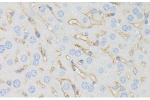 Immunohistochemistry of paraffin-embedded Mouse liver using IFITM1 Polyclonal Antibody at dilution of 1:100 (40x lens). (IFITM1 antibody)