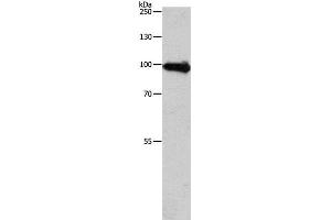 Western Blot analysis of Human fetal brain tissue using APLP1 Polyclonal Antibody at dilution of 1:650 (APLP1 antibody)