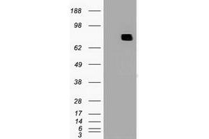 Image no. 1 for anti-Myxovirus Resistance Protein 1 (MX1) antibody (ABIN1499608) (MX1 antibody)