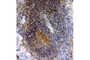 IHC analysis of GRK2 using anti-GRK2 antibody (ABIN5693069). (GRK2 antibody)