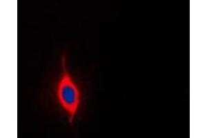 Immunofluorescent analysis of SURF1 staining in Jurkat cells. (SURF1 antibody  (Center))