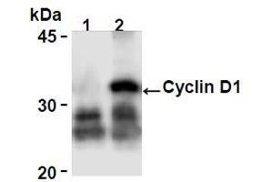 Western Blotting (WB) image for anti-Cyclin D1 (CCND1) antibody (ABIN1106871) (Cyclin D1 antibody)