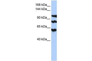 WB Suggested Anti-PPP1R13B  Antibody Titration: 0. (PPP1R13B antibody  (Middle Region))